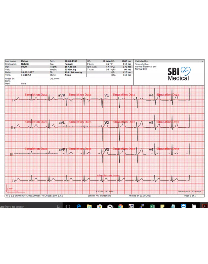 Brand New Schiller Cardiovit FT-1 EKG ECG Interpretative Machine 3 Yr Warranty